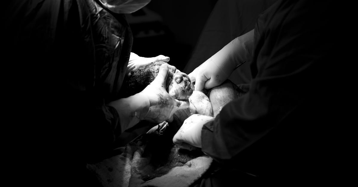 Césarienne : Comprendre les enjeux et les implications pour la mère et l’enfant
