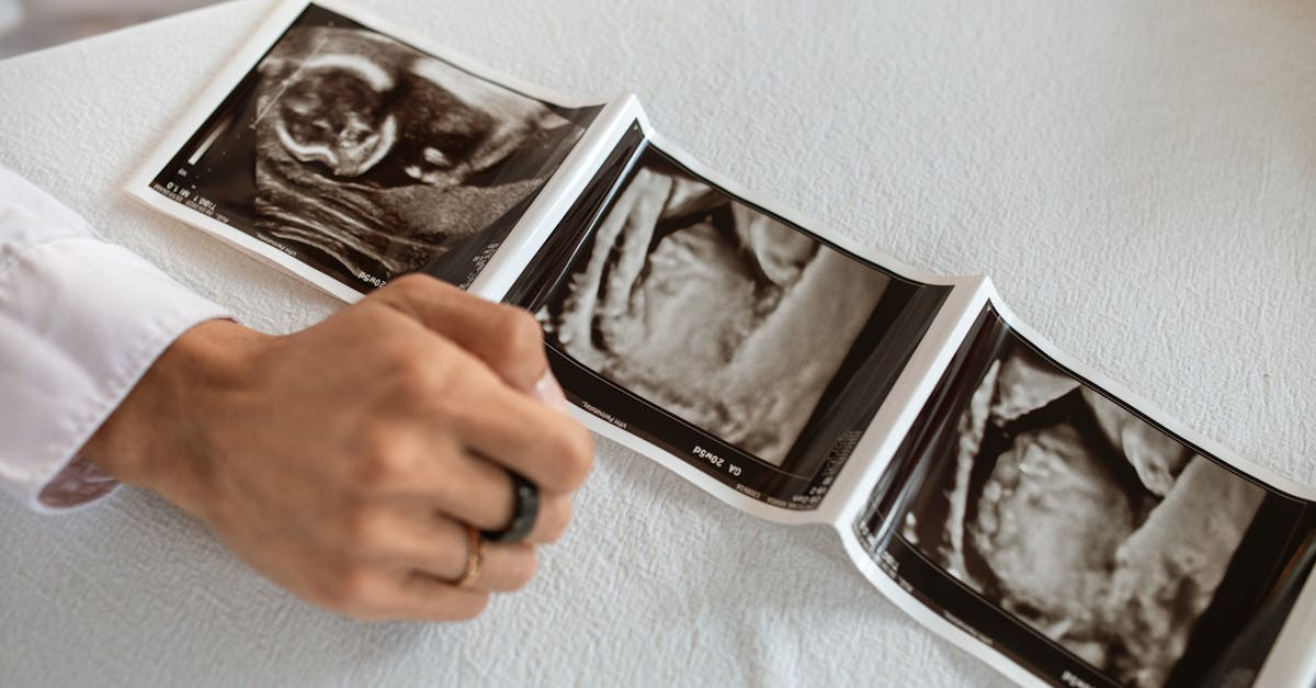 préparez-vous à l'arrivée de votre enfant avec notre guide complet sur la préparation à l'accouchement. découvrez des conseils pratiques, des techniques de relaxation et des informations essentielles pour vivre ce moment unique en toute sérénité.