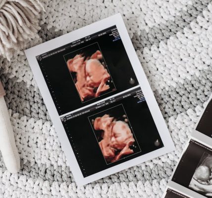 préparez-vous à accueillir votre bébé avec confiance grâce à notre guide complet sur la préparation à l'accouchement. découvrez des conseils pratiques, des techniques de relaxation et des informations essentielles pour vivre une expérience d'accouchement sereine et positive.