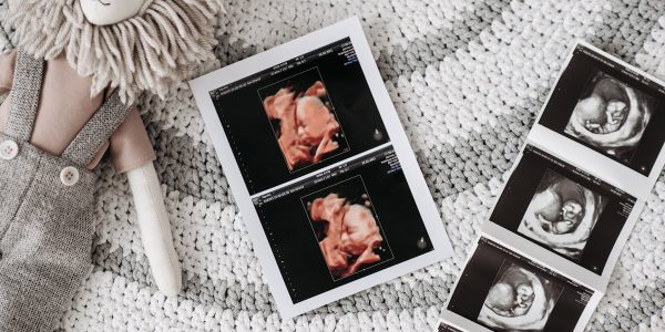 préparez-vous à accueillir votre bébé avec confiance grâce à notre guide complet sur la préparation à l'accouchement. découvrez des conseils pratiques, des techniques de relaxation et des informations essentielles pour vivre une expérience d'accouchement sereine et positive.