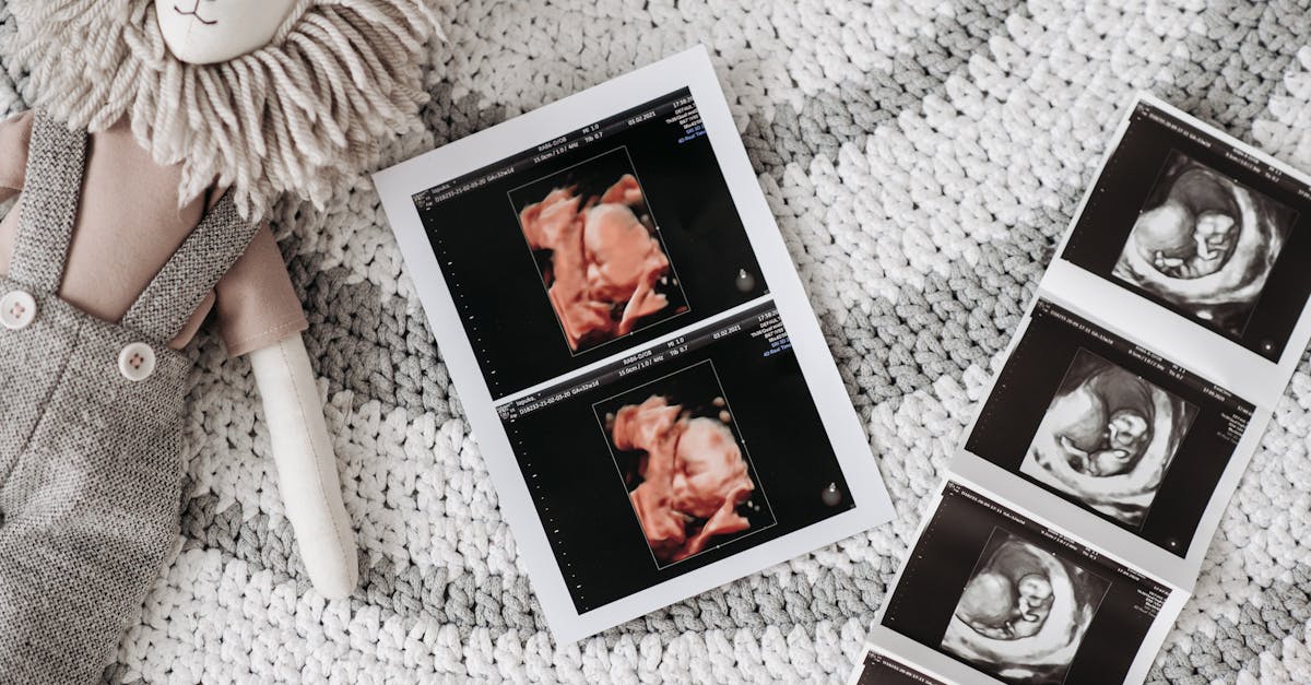 préparez-vous à accueillir votre bébé avec confiance grâce à notre guide complet sur la préparation à l'accouchement. découvrez des conseils pratiques, des techniques de relaxation et des informations essentielles pour vivre une expérience d'accouchement sereine et positive.