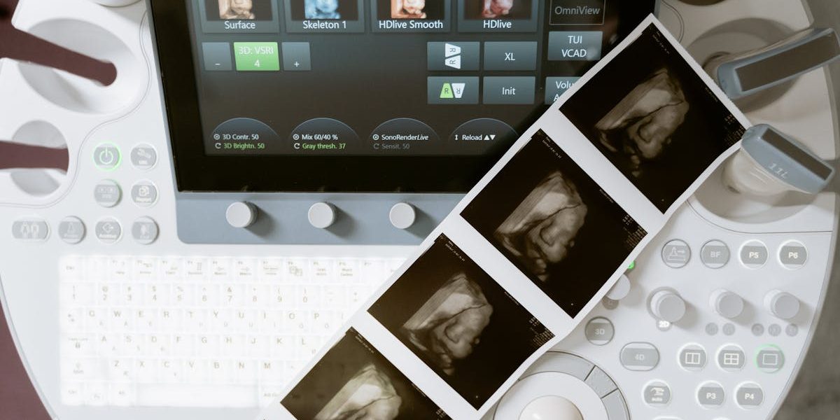 découvrez l'importance du suivi de grossesse pour assurer la santé de la maman et de l'enfant. apprenez les meilleures pratiques, conseils et outils pour une grossesse épanouie et sereine.