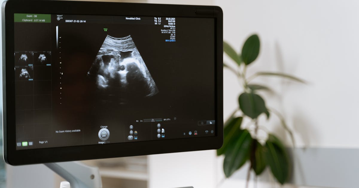 suivez de près votre grossesse grâce à nos conseils et outils de suivi de la santé. restez informée sur le développement de votre bébé, les examens essentiels et les étapes clés à chaque trimestre pour une expérience sereine et sécurisée.