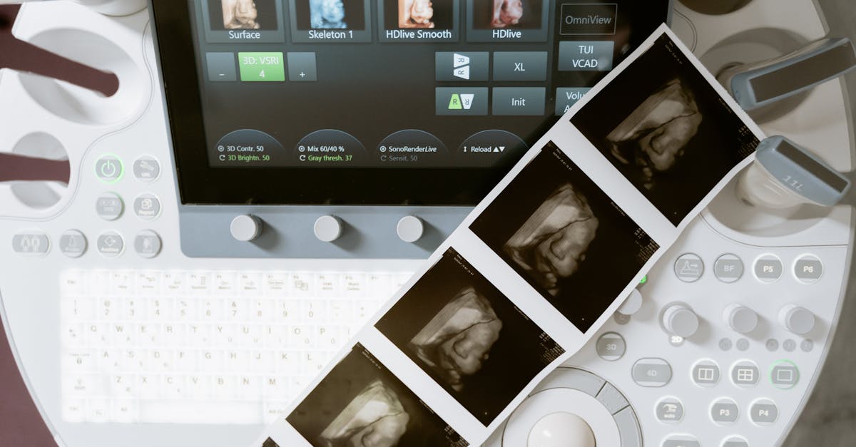 découvrez l'importance du suivi de grossesse pour assurer la santé de la maman et de l'enfant. apprenez les meilleures pratiques, conseils et outils pour une grossesse épanouie et sereine.