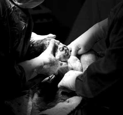 découvrez tout sur la césarienne : procédures, raisons, avantages et inconvénients. informez-vous sur cette intervention chirurgicale qui sauve des vies et accompagne les futures mamans.