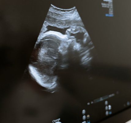 découvrez les avantages et les applications de l'échographie, une méthode d'imagerie médicale non invasive, utilisée pour le diagnostic et le suivi de diverses conditions de santé. informez-vous sur son importance en obstétrique, cardiologie et autres spécialités médicales.