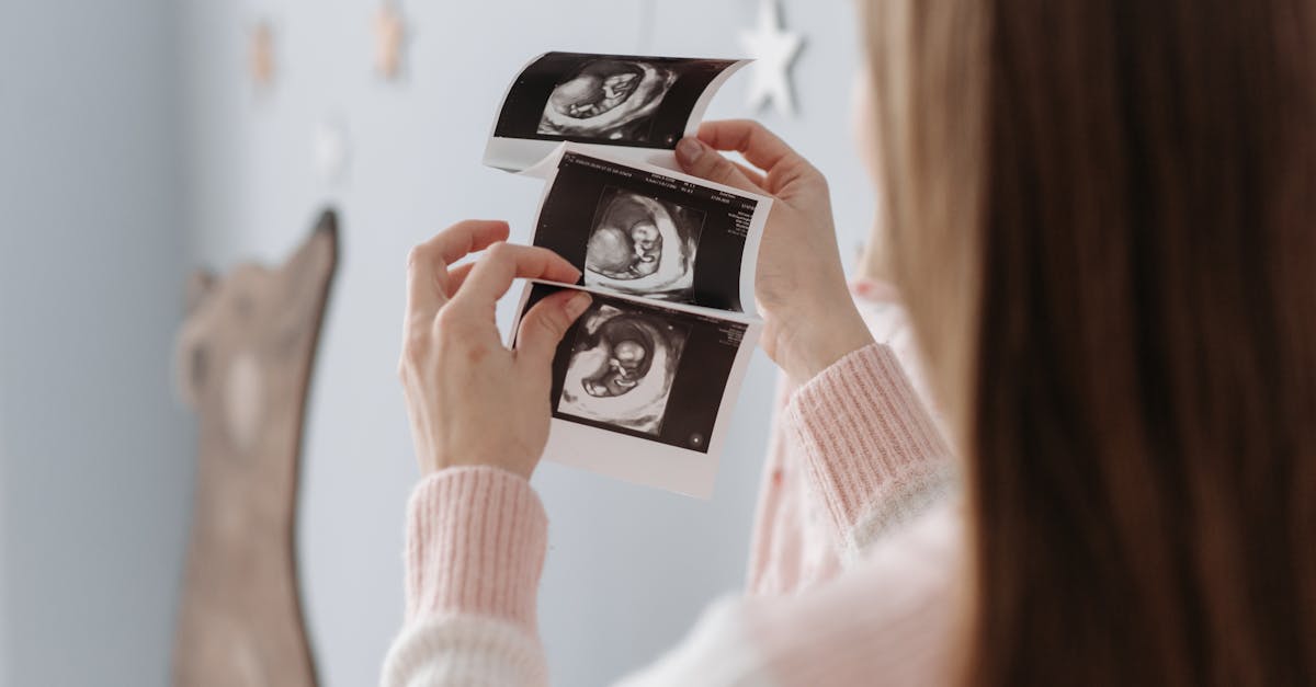 découvrez tout ce qu'il faut savoir sur la grossesse avec notre guide complet sur le prénatal. des conseils santé, des informations sur le développement du fœtus, et des astuces pour vivre sereinement cette période unique de votre vie.