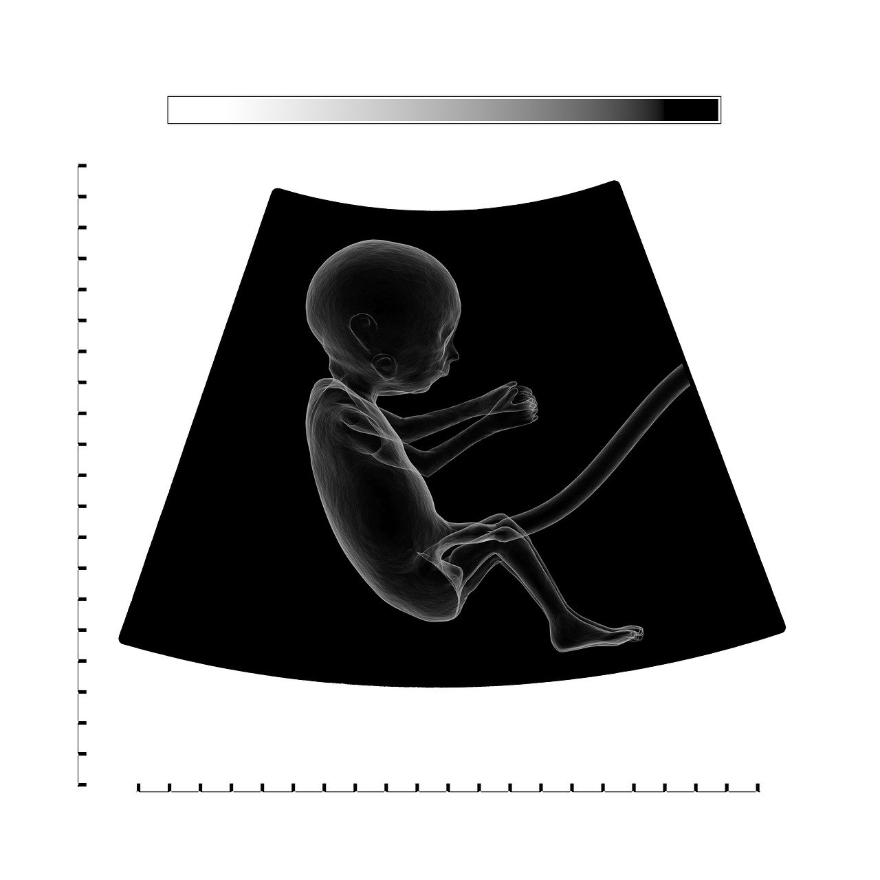 découvrez tout ce qu'il faut savoir sur les ultrasons : fonctionnement, applications médicales et industrielles, avantages et précautions à connaître.